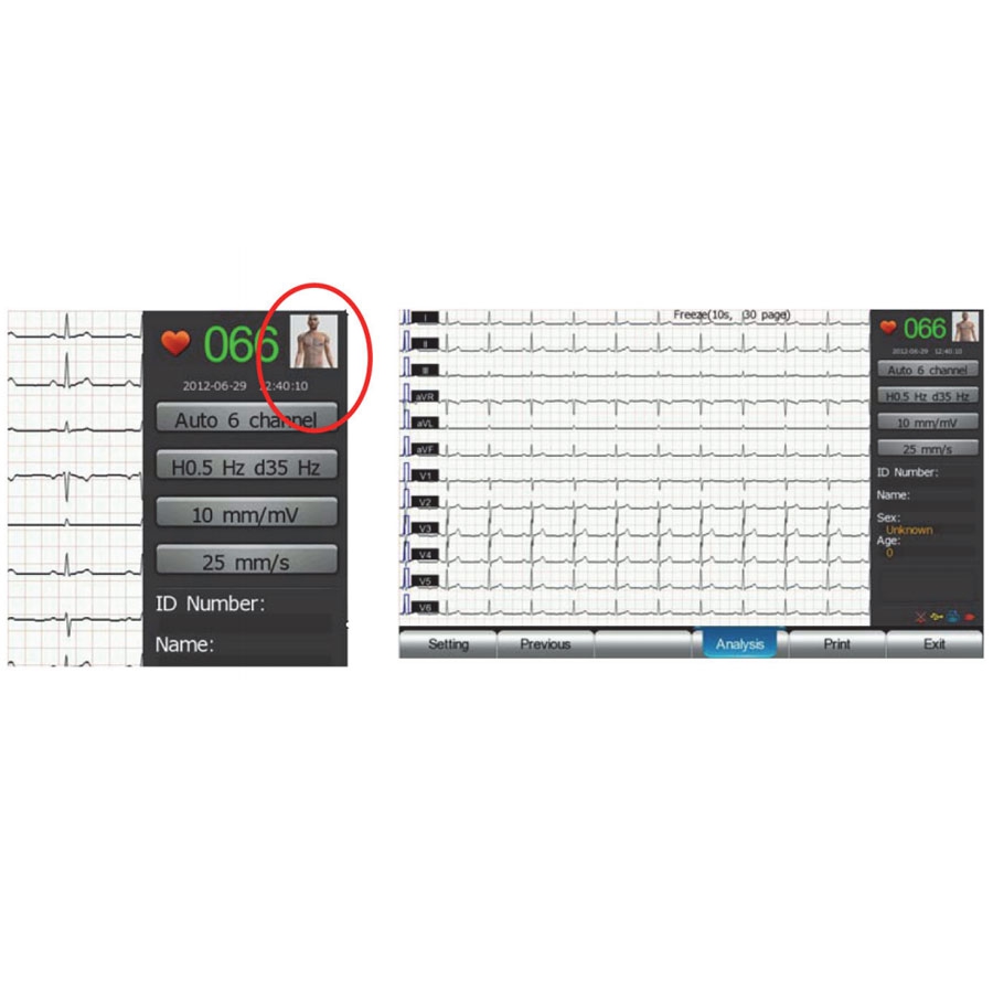 Electrocardiographe Biocare iE 12A avec calcul et interprétation g2