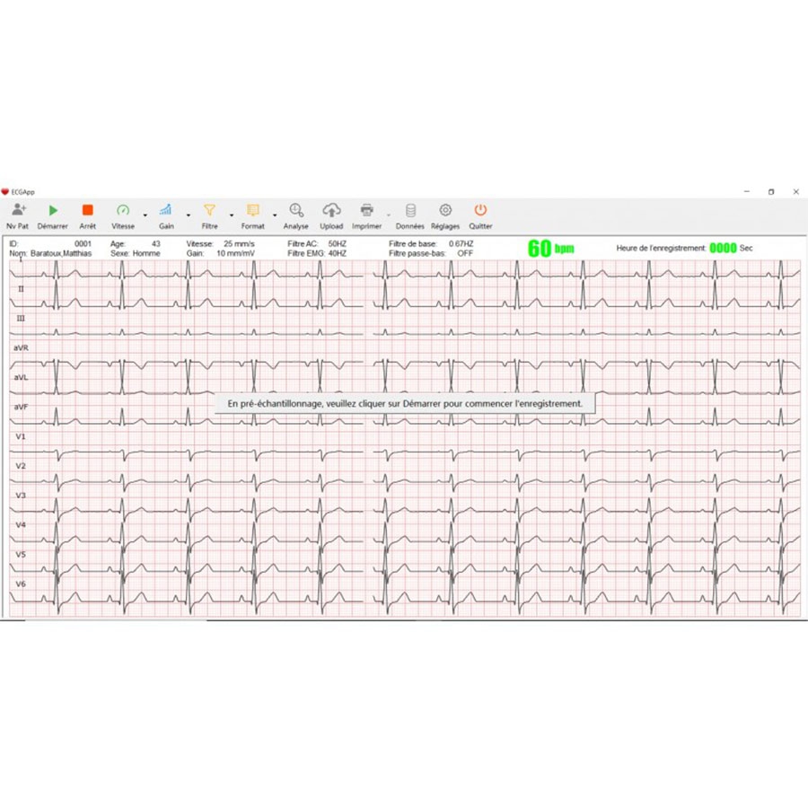 Electrocardiographe Cardiomate PC-ECG Bluetooth Spengler g9