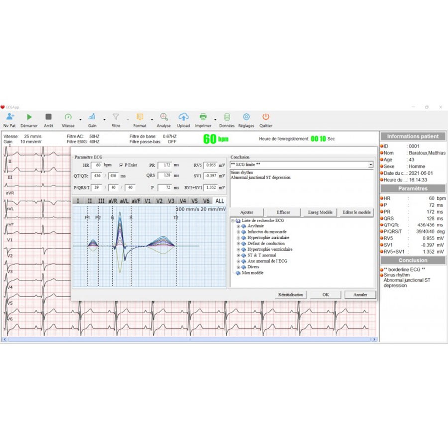 Electrocardiographe Cardiomate PC-ECG USB Spengler g7