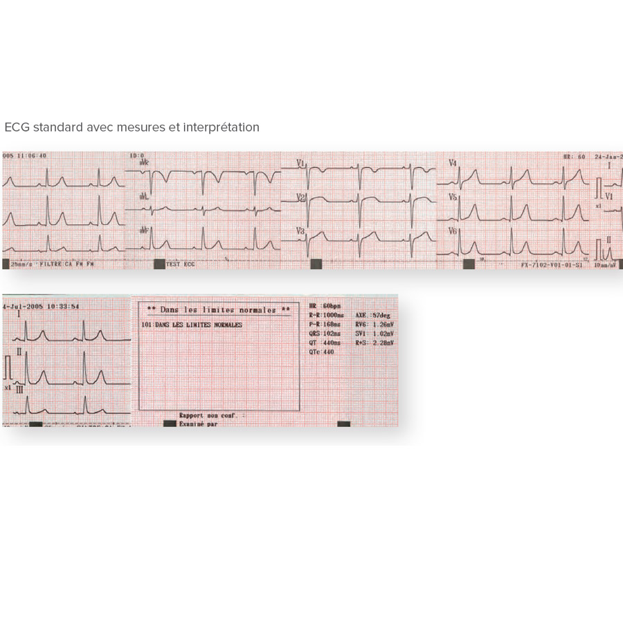 Electrocardiographe Fukuda Denshi Cardimax FCP 8100 g5