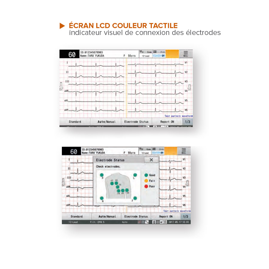 Electrocardiographe Fukuda Denshi Cardimax FX 8200 g3