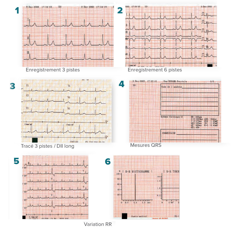 Electrocardiographe Fukuda Denshi Cardimax FX 8200 g4