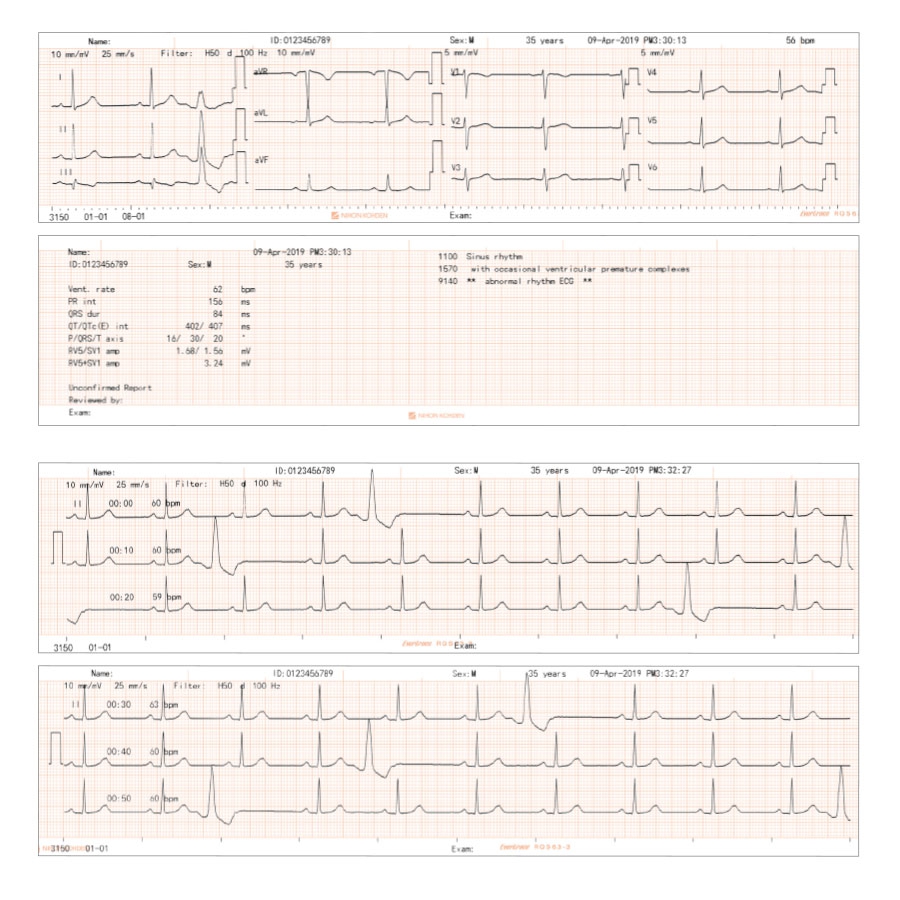 Electrocardiographe NIHON KOHDEN Cardiofax C-3150 g7