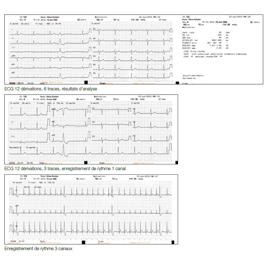 Electrocardiographe NIHON KOHDEN Cardiofax S-2250 g3
