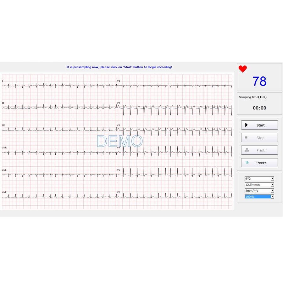 Electrocardiographe numérique USB EDAN SE-1515 g7