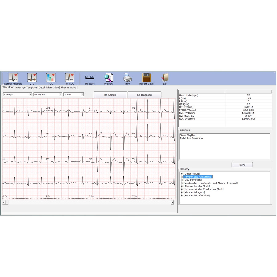 Electrocardiographe numérique USB EDAN SE-1515 g8