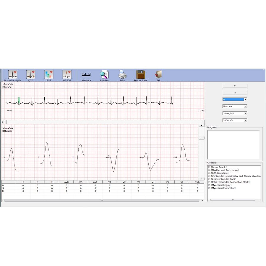 Electrocardiographe numérique USB EDAN SE-1515 g9