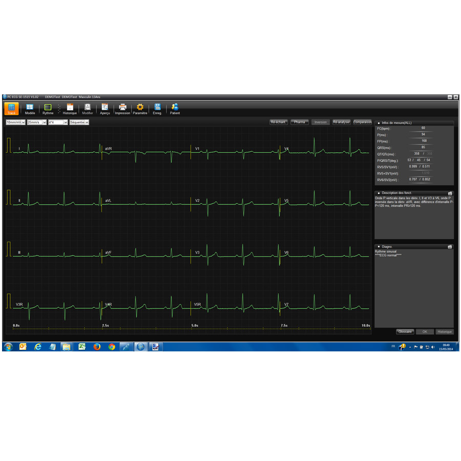Electrocardiographe numérique sans fil EDAN SE-1515 g7