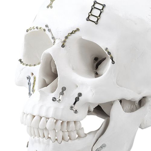 MAXILLO-FACIAL